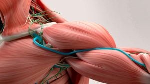 thoracic outlet syndrome