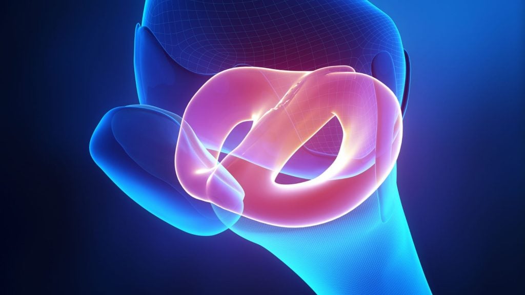 Le suture meniscali: prospettiva dell'ortopedico