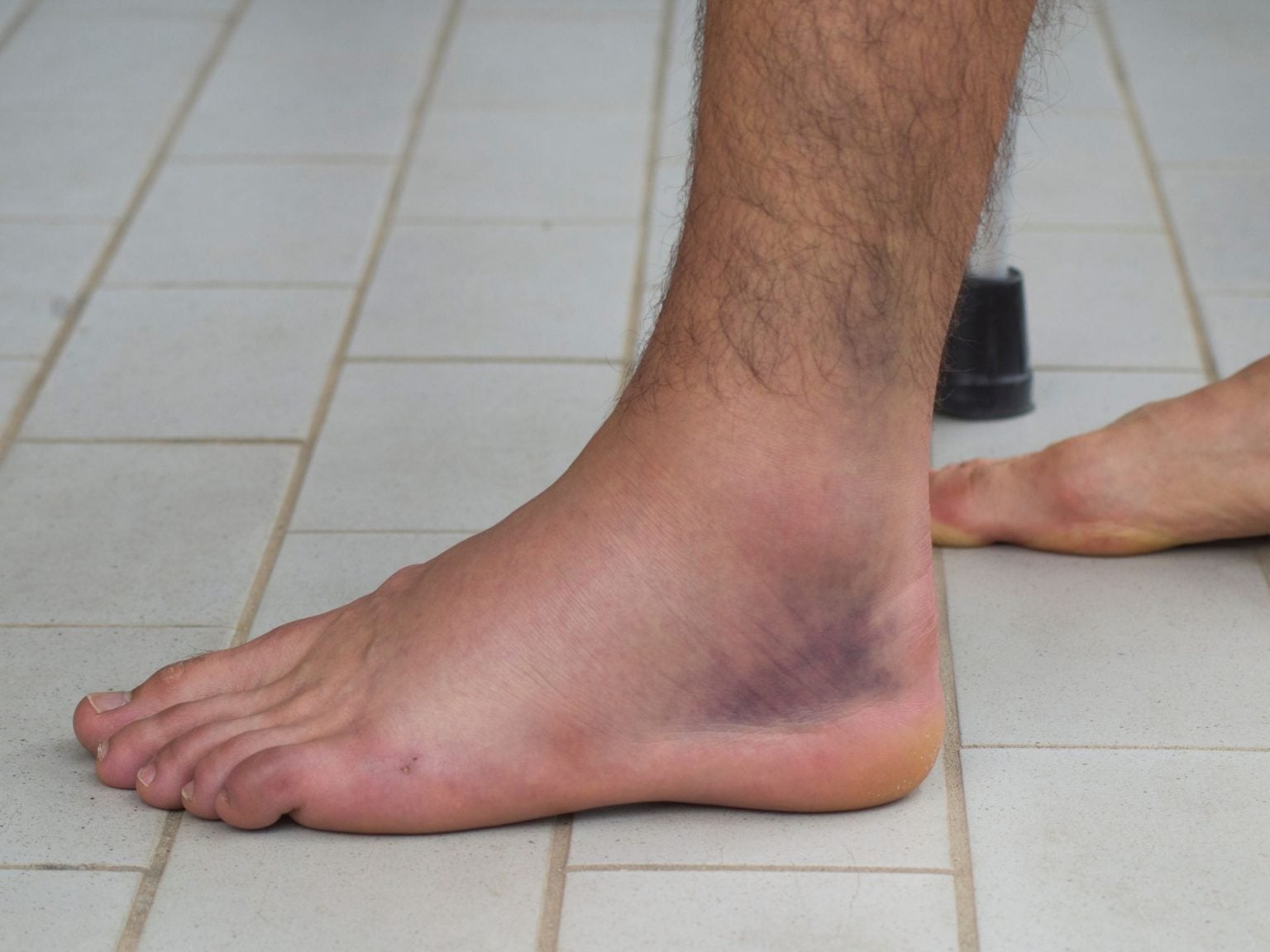 Fasciatura Ortopedica Complementare Elastica, Caviglia Dello Stabilizzatore Di Compressione Isolata Su Bianco 76786273