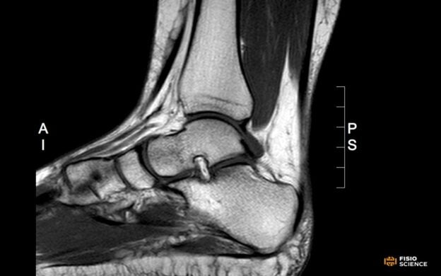 traumi distorsivi caviglia corso cover