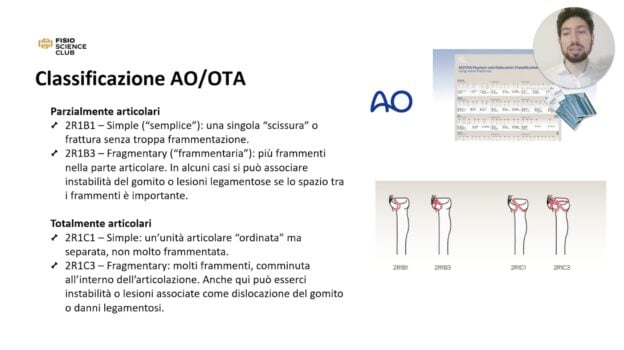 corso fratture di gomito