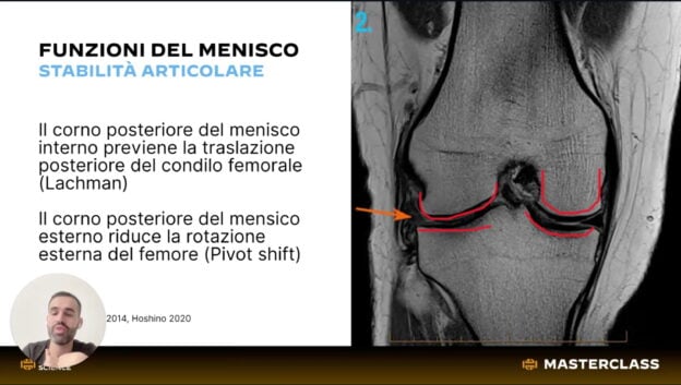 masterclass lesioni meniscali (1)